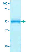 SDS-PAGE Gel